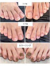 ケアプラス(care plus)/フットマニキュアカラー