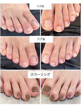 ケアプラス(care plus)/フットマニキュアカラー