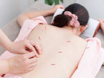 縁/様々な不調に 鍼灸治療