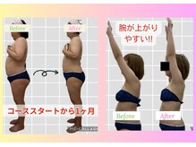 シャンべリールの雰囲気（つらいガチガチ筋肉がふわっとやわらかくなって根本改善へ！！）