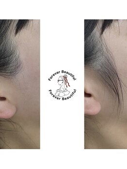 フォーエバービューティフル(Forever Beautiful)/