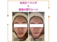 ラウレア(Laule'A)