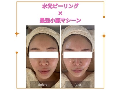 ラウレア(Laule'A)の写真