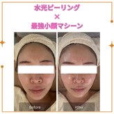 ラウレア(Laule'A)