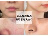 【初めての方】たるみ毛穴ケア小顔体験60分