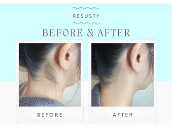 モードケイズ eau 摂津本山店(MODE K's)の写真/【摂津本山駅すぐ】東灘区の大人気ヘアサロンでできる"うなじ脱毛"都度払いで気軽さ◎