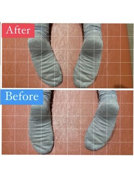 ナオル整体 宮崎院(NAORU整体)/20代女性施術事例【産後の歪み】