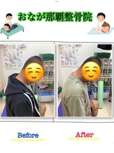 おなが浦添当山整体院/クビ・肩の痛み、可動域改善！