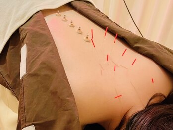 茶ノ木鍼灸整骨院/