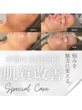 グレイス(Grace)/