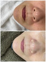 ヒルナム(Heal Nam)/プロセルセラピーズ~フェイス~