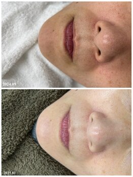 ヒルナム(Heal Nam)/プロセルセラピーズ~フェイス~