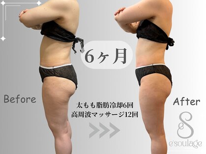 エスラージュ(esoulage)の写真