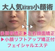 キララ 美容矯正