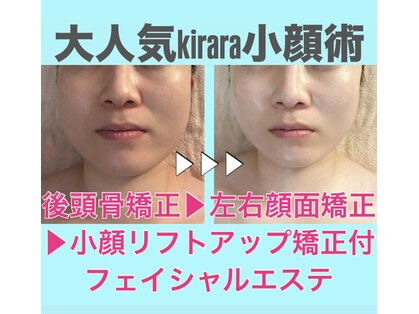 キララ 美容矯正の写真