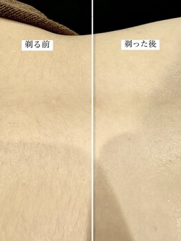 銀座シノ 灯 HANARE(shino)/お腹のシェービング