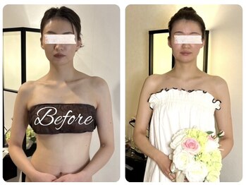 蒼(so)/短時間の施術では解決できない↓