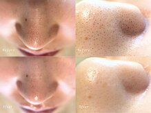 リセットプラス(Reset+)