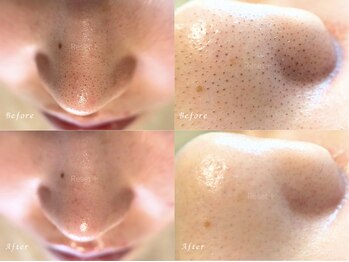 リセットプラス(Reset+)