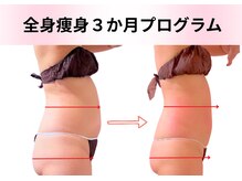 エルナ(Eluna)/本格痩身105分コース