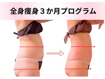 エルナ(Eluna)/40代全身10回 全身105分コース