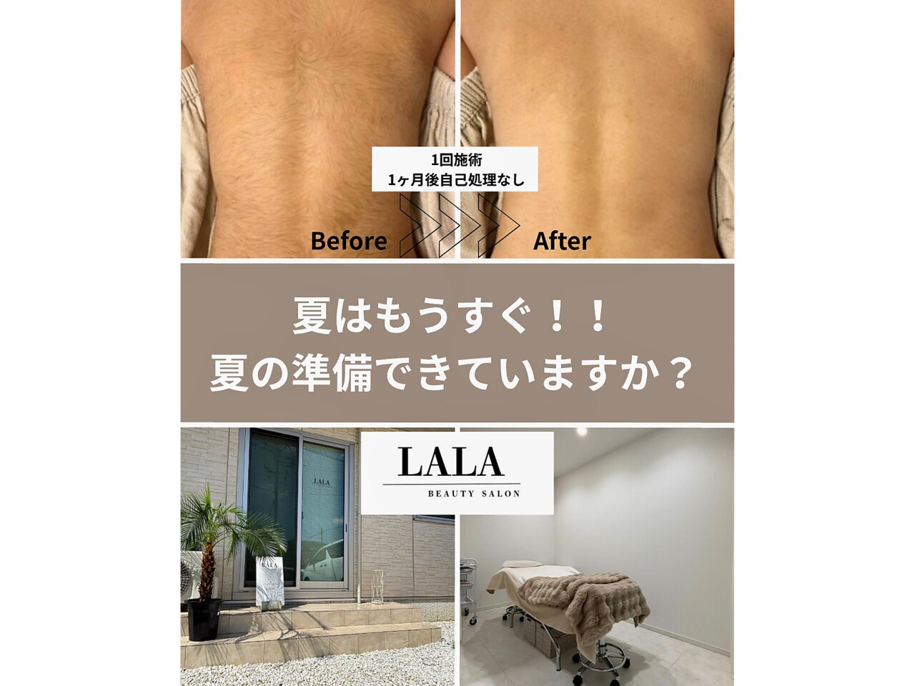 LALAさん専用ページ Renewal】LaShade STARTER KIT