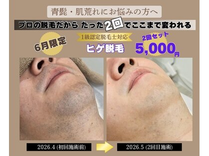 フォー(the 4)の写真