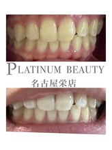 プラチナムビューティー 名古屋栄本店(PLATINUM BEAUTY)/お客様Before After