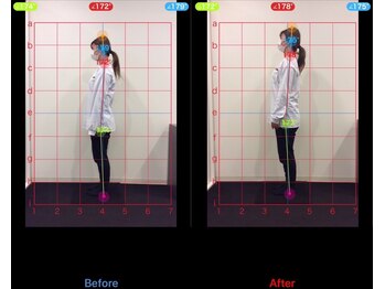 ケアルーム 茅ヶ崎(CAREroom)/施術効果写真☆(before after)