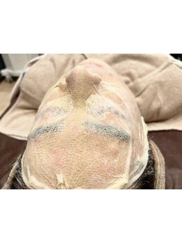 シミしわ改善！予防ケア