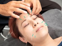 鍼灸マッサージおおふな堂/小顔美容鍼