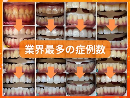 ホワイトニングセンター 大阪京橋店の写真