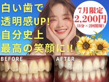 LBSホワイトニング 新宿店