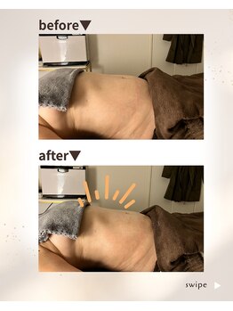 ベルヴィー(Belle.vie)/寝ているだけのお腹ケア