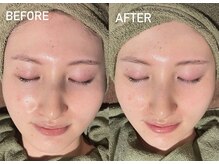 ナナ(Nana)/効果絶大小顔ケア