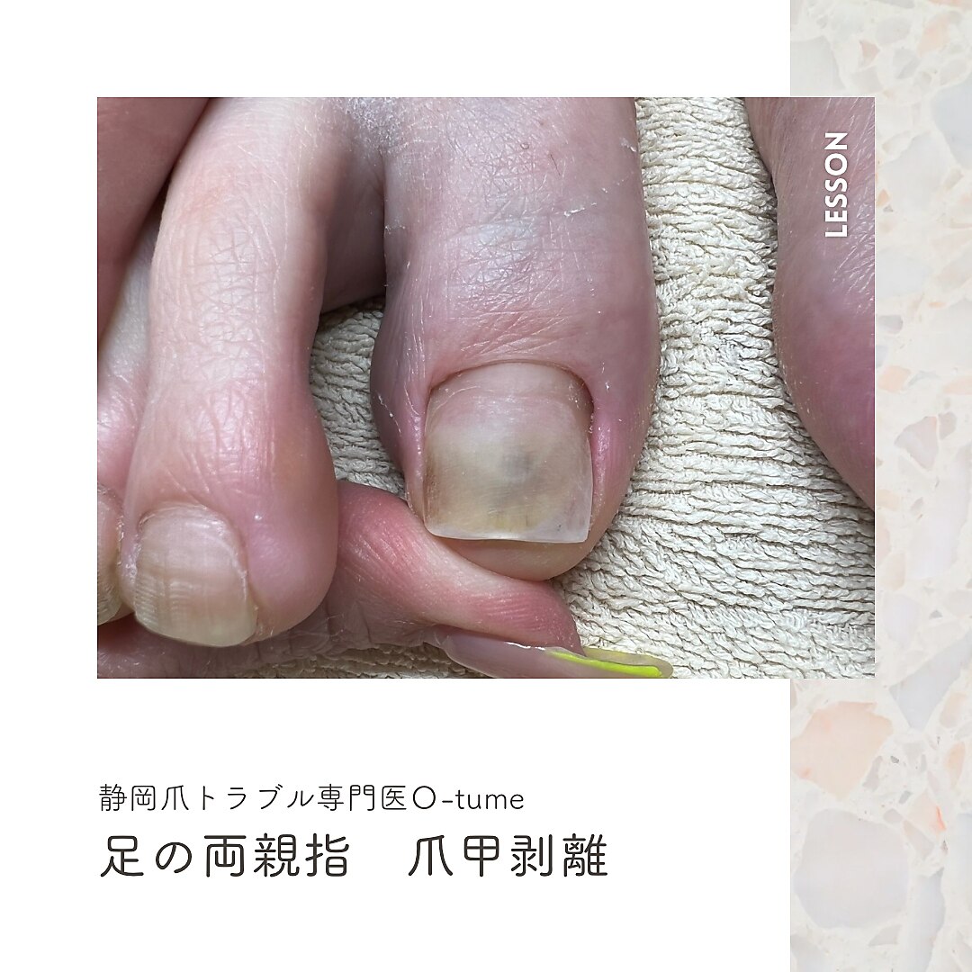 オツメ 静岡(O-tume)｜ホットペッパービューティー