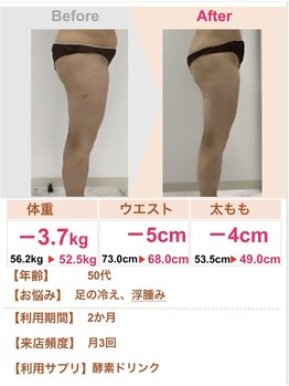 スリムステーション 高槻駅前(Slim Station)/下半身も痩せる！