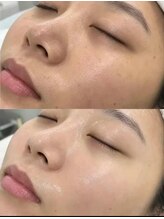 ドクタースタイル(Dr.style)/体験者の95％がすぐに効果を実感