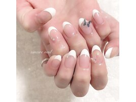 バタフライ
