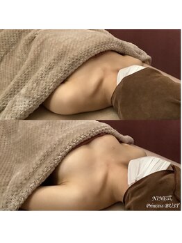 ココシア 取手店(COCOCIA)/バストアップ症例★