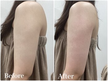 ルピア(L'pur)/痩せたい部分を集中！