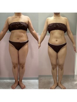 セカンドハウス(Second house)/ビフォーアフター(Ｙ様)