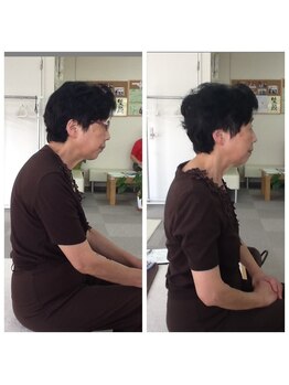 てんゆう整体/姿勢が改善され身長が伸びた