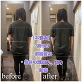 eMe和筋膜リリース