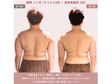 マーリエ(Malie)の雰囲気（【期間2ヶ月！！】50代でも続ければここまで変われます♪）