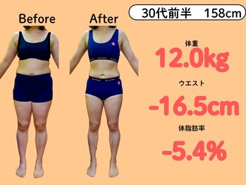 新飯塚中央整体院/30代 -12kg 本気のダイエット1