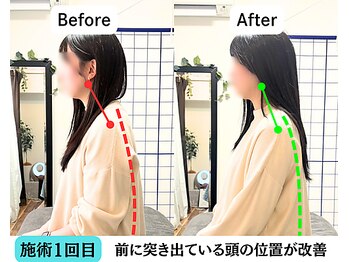 整体院 爽良/【札幌/大通り】姿勢改善