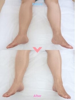トトノエ ファン(Fa-N)の写真/むくみ、足の張り、重い…足裏から整える、リフレクソロジーで反射区を刺激し、全身の巡りを促進!