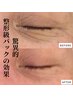 【新導入！？】艶肌革命☆炭酸ガスパックで水光肌ケア70分￥14,730→￥9,900