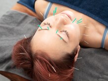 鍼灸マッサージおおふな堂/頬すっきり美容鍼